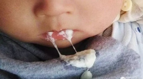宝宝吐奶怎么办 宝宝吐奶怎么办